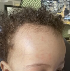 Baby rash or being pedantic?! PICS INCLUDED