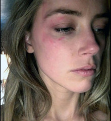 Anyone watching Amber heard take the stand?