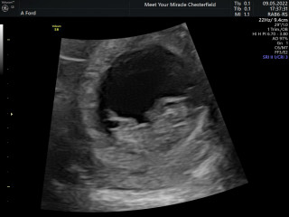 Due December '22 thread 2!