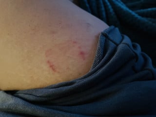 Any advice for patch application?