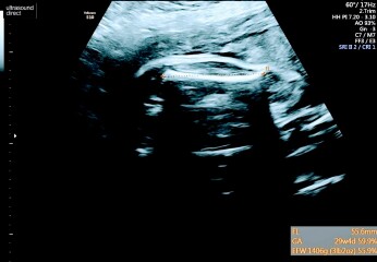 Gender guesses 💗💙💗💙