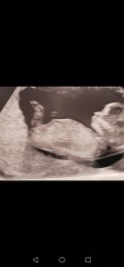 Boy or girl? guesses much appreciated :) 