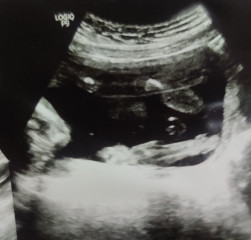 Any gender guesses for my baby..? 