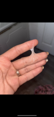 Mucus plug??