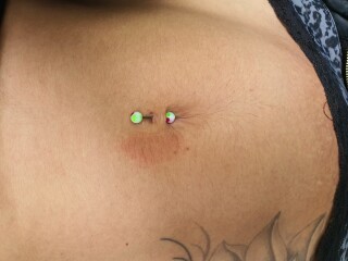 Strange skin rashes