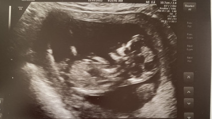 Just for fun... Gender guesses welcome