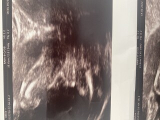 Gender scan 