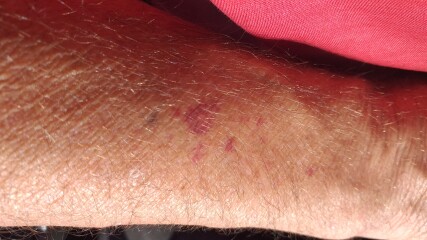 Anyone know what this is or may cause it?