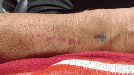 Anyone know what this is or may cause it?