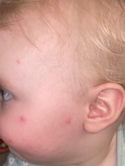 What are these spots?! 