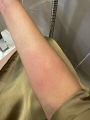 Is this an infection? Help! (Photos attached)