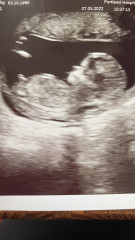 Boy or girl? :)