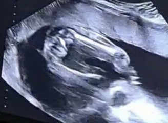 Gender guesses please ❤️