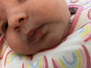 Baby cold sore? Or pimple? Help!!