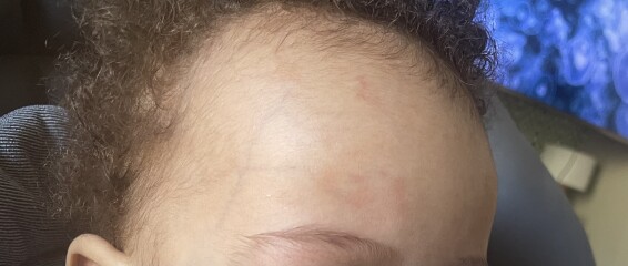 Baby rash or being pedantic?! PICS INCLUDED