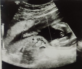 Any gender guesses for my baby..? 