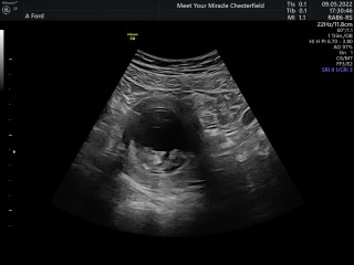 Due December '22 thread 2!