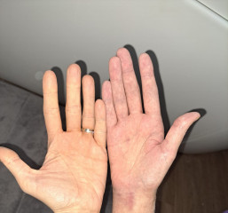 Please help with my hand **Pic included**