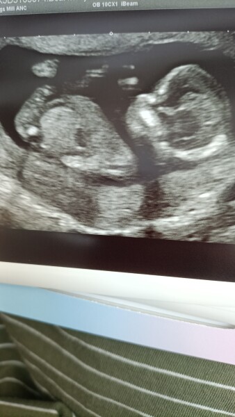Guess the gender?