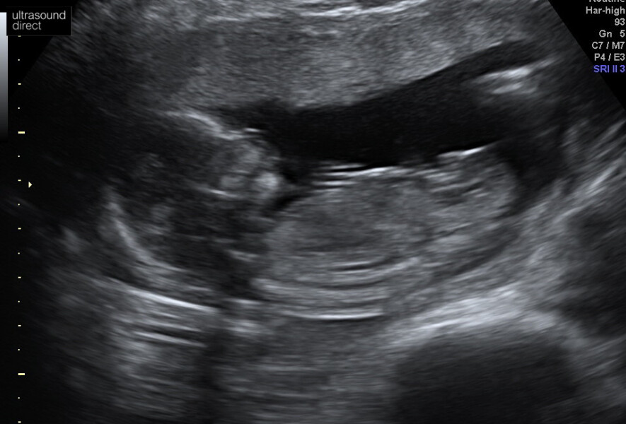 Due December 2022 thread 3