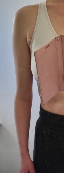 How did she get these arms?