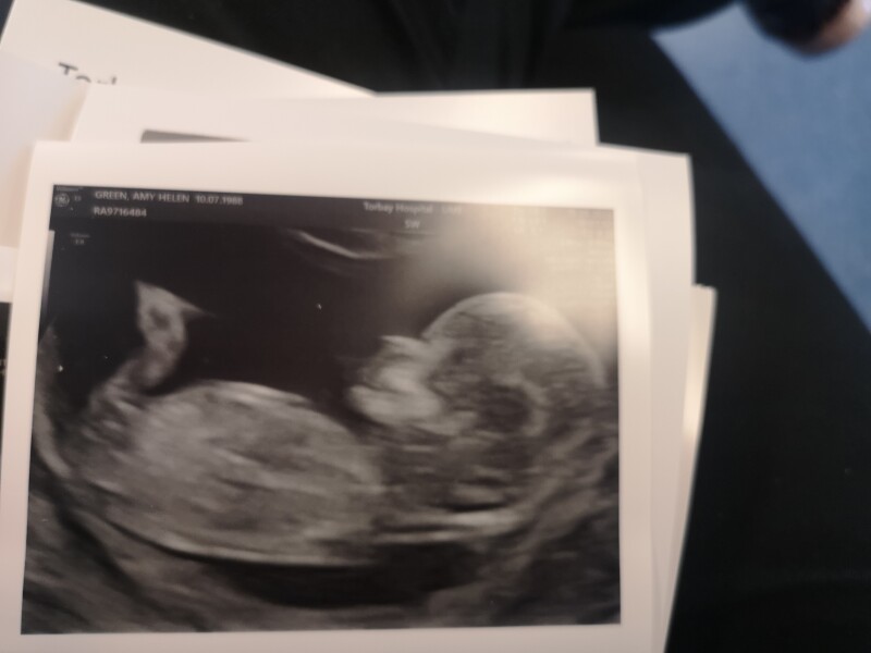 Due December 2022 thread 3
