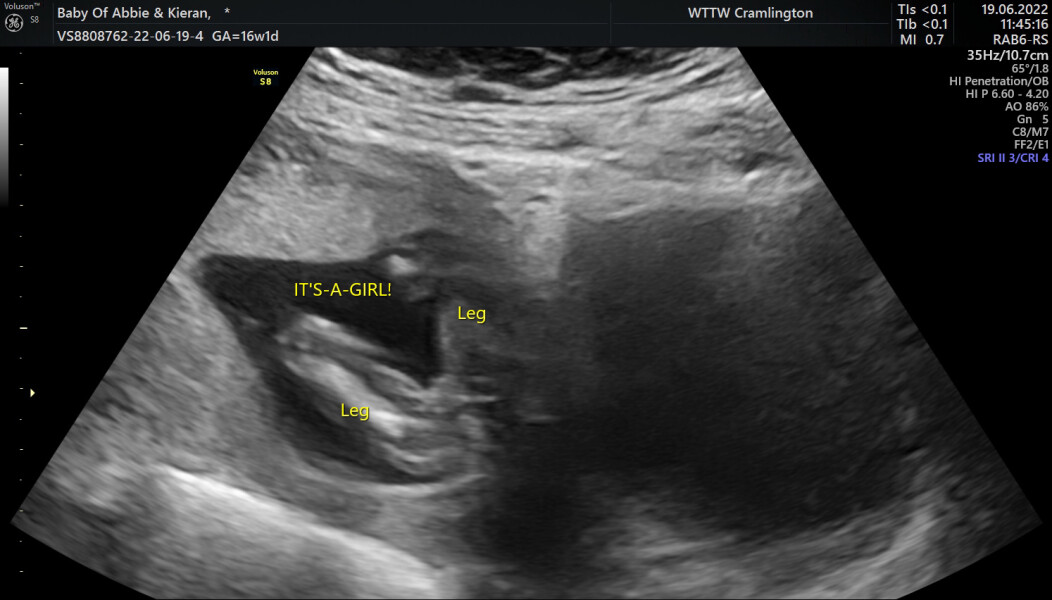 Gender guesses/nub theory? 