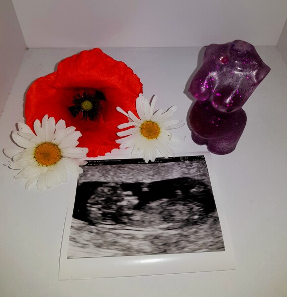 Pregnancy after miscarriage - thread 2