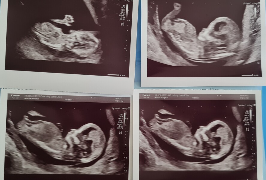 Due December 2022 thread 3
