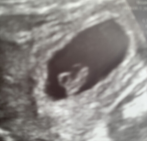 No one to talk to about early pregnancy irl