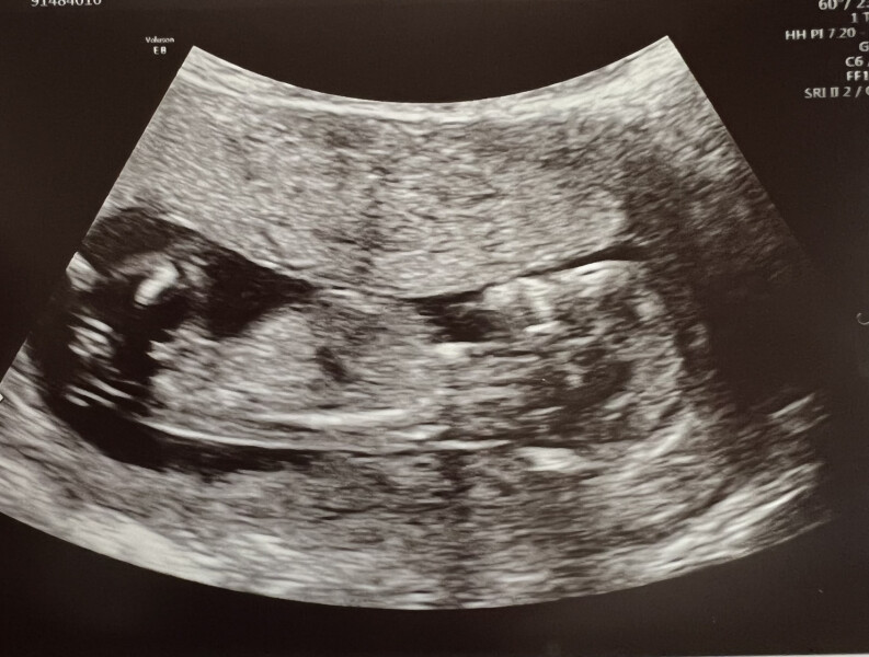 Temptation to find out gender! Help