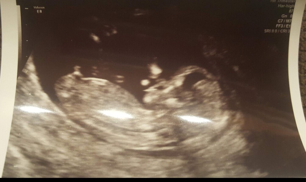 Due December 2022 thread 3