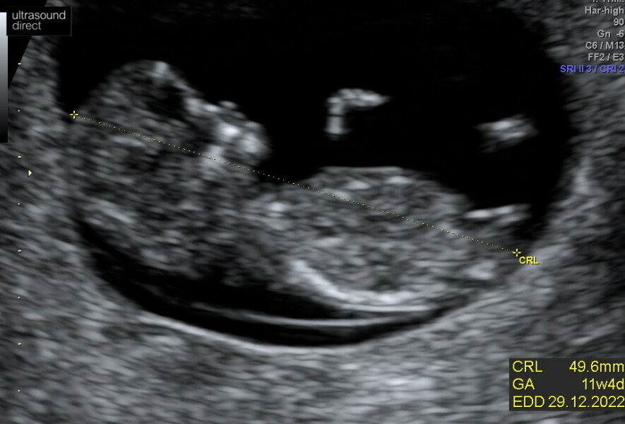 Due December 2022 thread 3