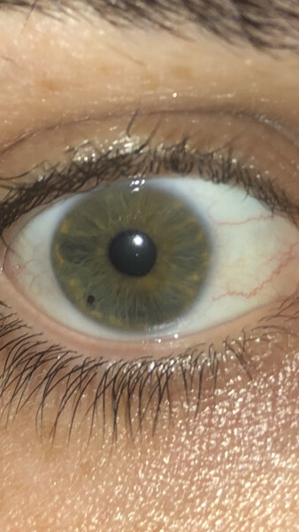 What colour is this eye?