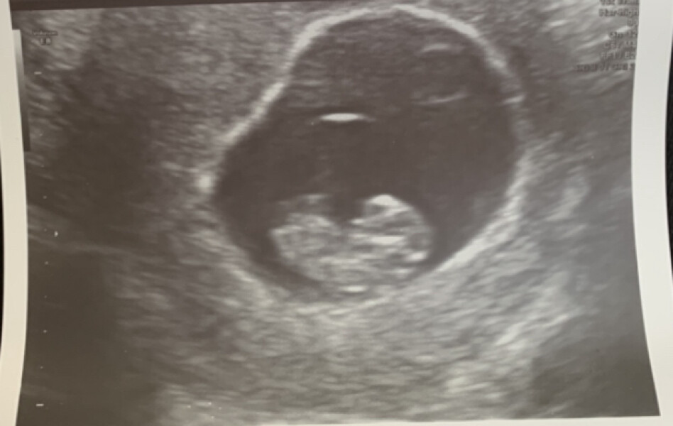 Baby January 2023!
