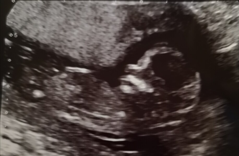 Gender guesses 