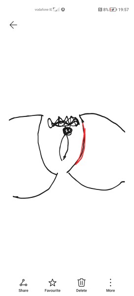 Weird pain on the inside of the pubic bone/leg
