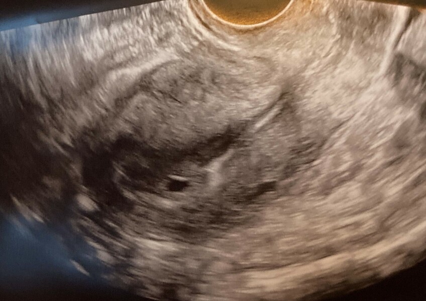 Does this look like 1 or twins?
