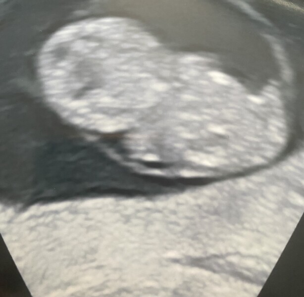 7 weeks 1 day pregnant 