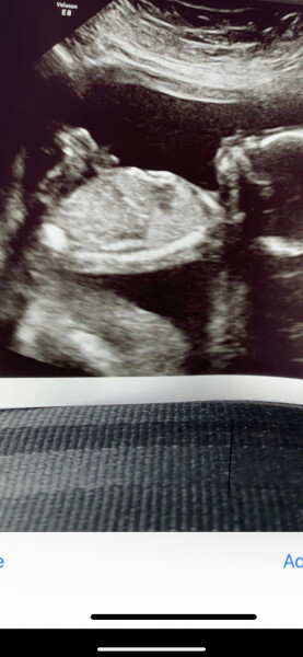 Gender guess. 