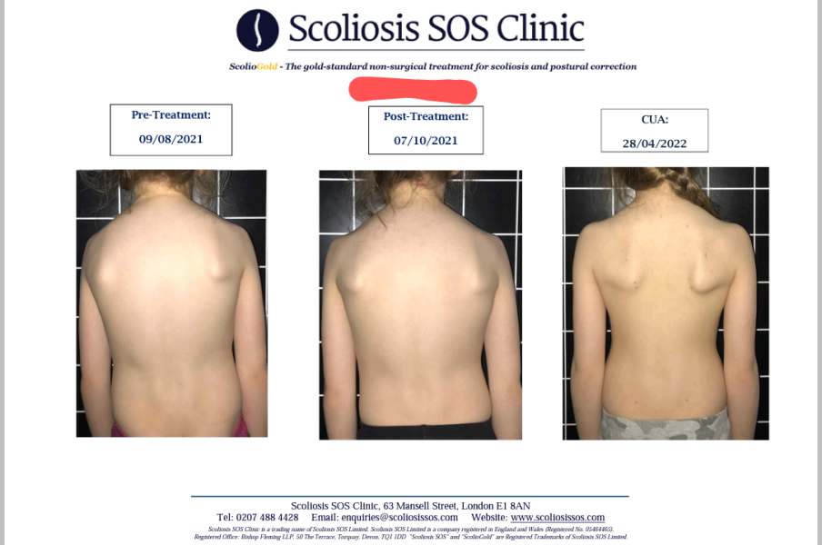 To get a second opinion on my sons back - photos attached 