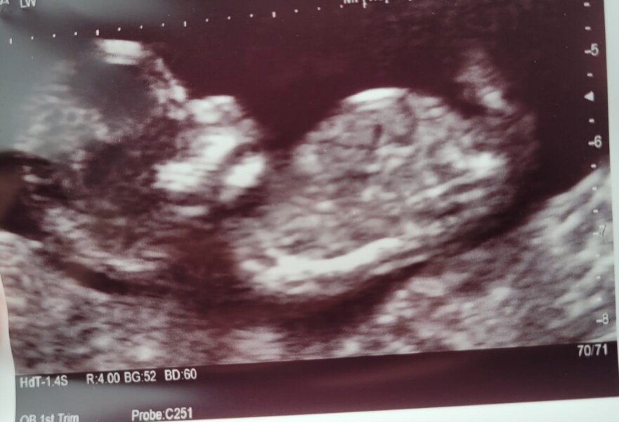 Due December 2022 thread 3