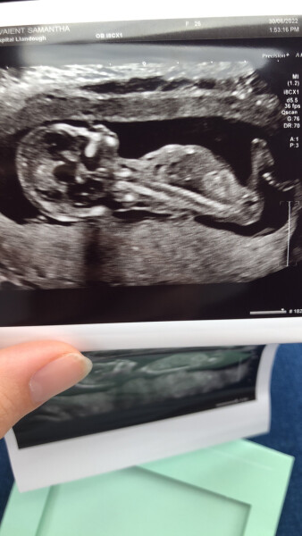 Gender guesses? 13+4