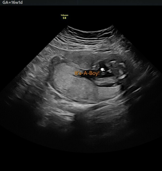 Due December 2022 thread 3