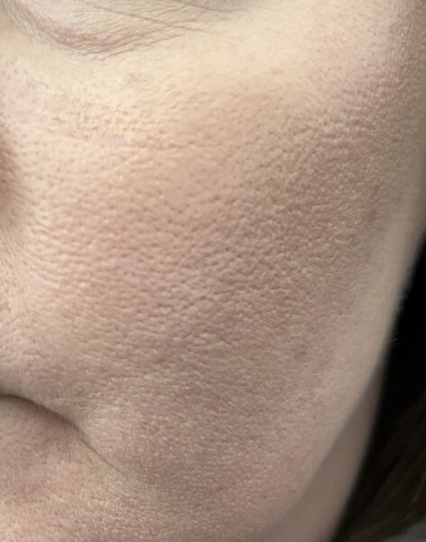 Help my skin!