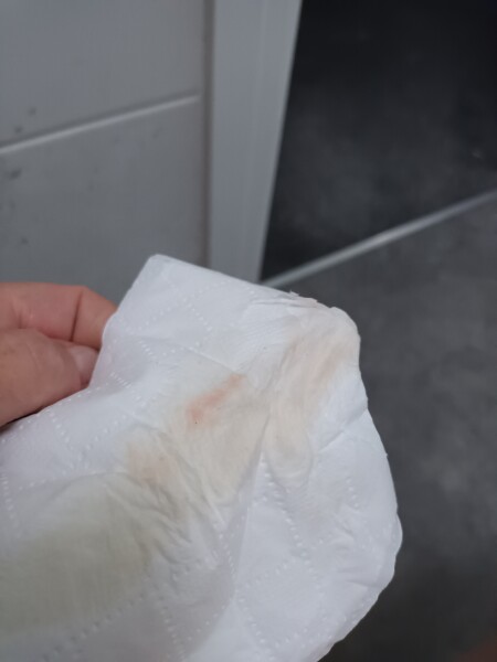 bleeding/spotting...