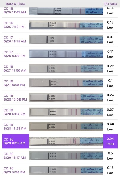 Did I ovulate? With pic