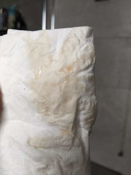 TMI picture....please tell me this isn't a miscarriage pending...