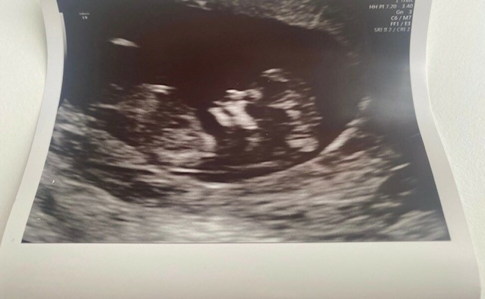 Boy or girl - just for fun! 