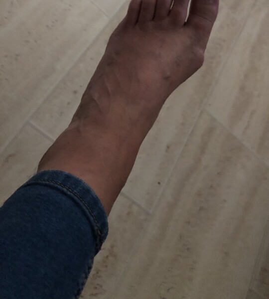 52 and with bloody bad bunions….